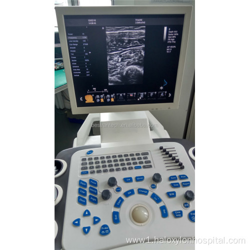 Full digital 4D Laptop color doppler Ultrasound Machine